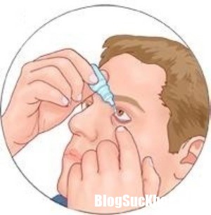huong dan su dung thuoc nho mat dung cach hinh 2 Bảo vệ mắt khỏi các dịch bệnh mùa hè nhờ sử dụng thuốc nhỏ mắt đúng cách